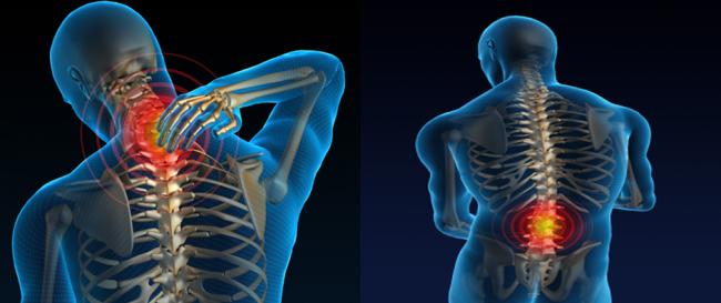 Muscle and Joint Pain