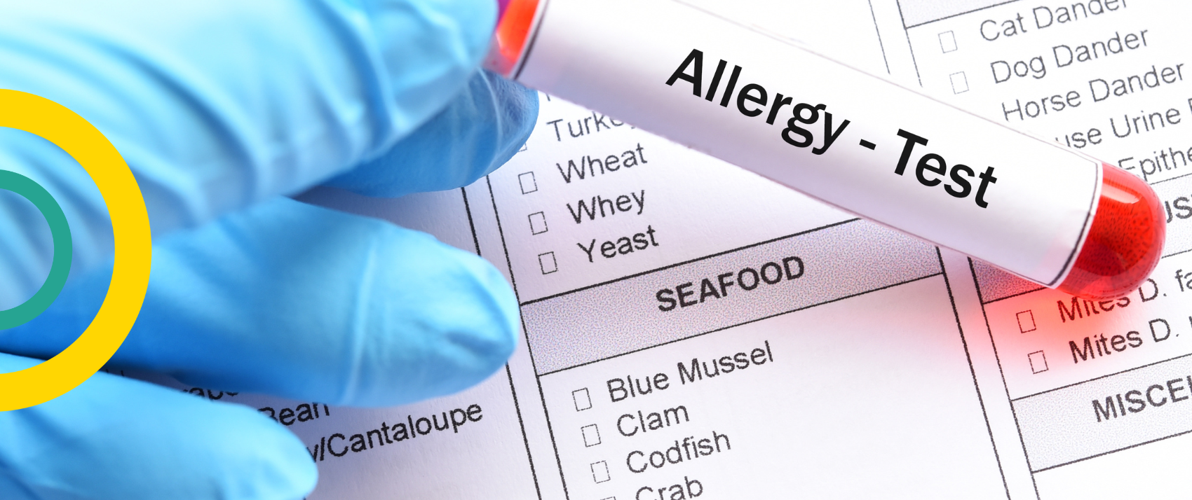 Food Allergy TEST